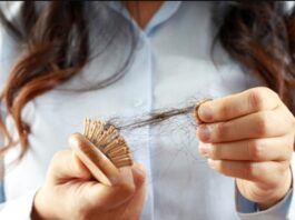 Causes of Severe Hair Loss